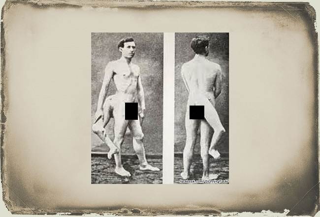 Frank Lentini Çıplakken